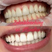 Zahnbleaching Schulung Baden-Württemberg - Reutlingen Vorschau