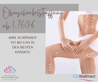 Oberschenkelstraffung ab 1.760 Euro Baden-Württemberg - Birenbach Vorschau