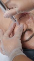 Microneedling Pro Baden-Württemberg - Löchgau Vorschau