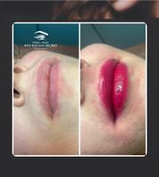 BBGLOW und BBLIPS Pigment Ampullen für Beautysalon - MakeUp Teint Hamburg-Mitte - Hamburg Neustadt Vorschau