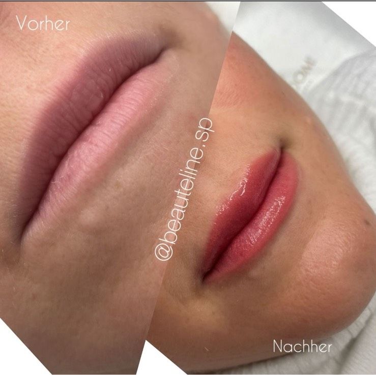 Lippenpigmentierung in Delmenhorst