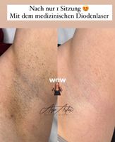 Medizinischer Diodenlaser MeDioStar Achslen Nordrhein-Westfalen - Werne Vorschau