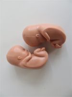 therapeutische Embryo, Verlorener Zwilling, Anatomie, Aufklärung Leipzig - Gohlis-Mitte Vorschau
