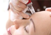 Microneedling ميكرونيدلنغ Niedersachsen - Helmstedt Vorschau