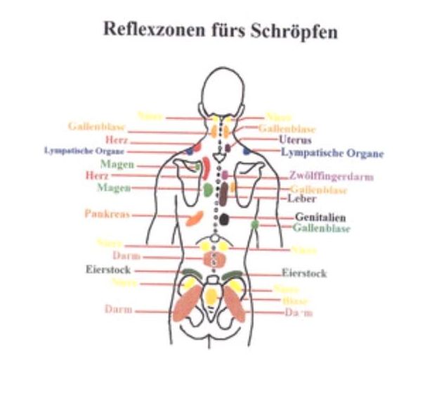 Schröpfen / Hacamat in Frankfurt am Main