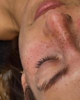 Sommersprossen PermanentMakeup, Kiel - Elmschenhagen-Kroog Vorschau