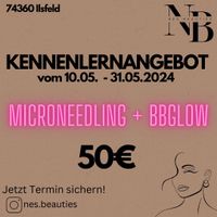 Microneedling + BBGlow Baden-Württemberg - Ilsfeld Vorschau