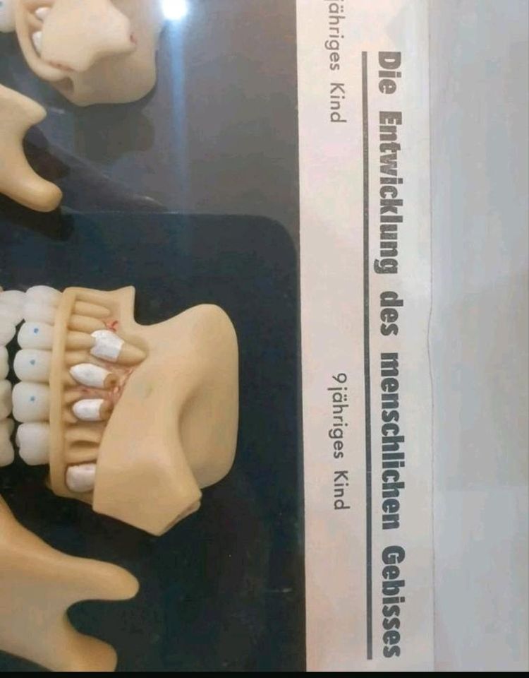 Rarität Schaukasten Modell menschliches Gebiss Vitrinen Zahnarzt in Pössneck