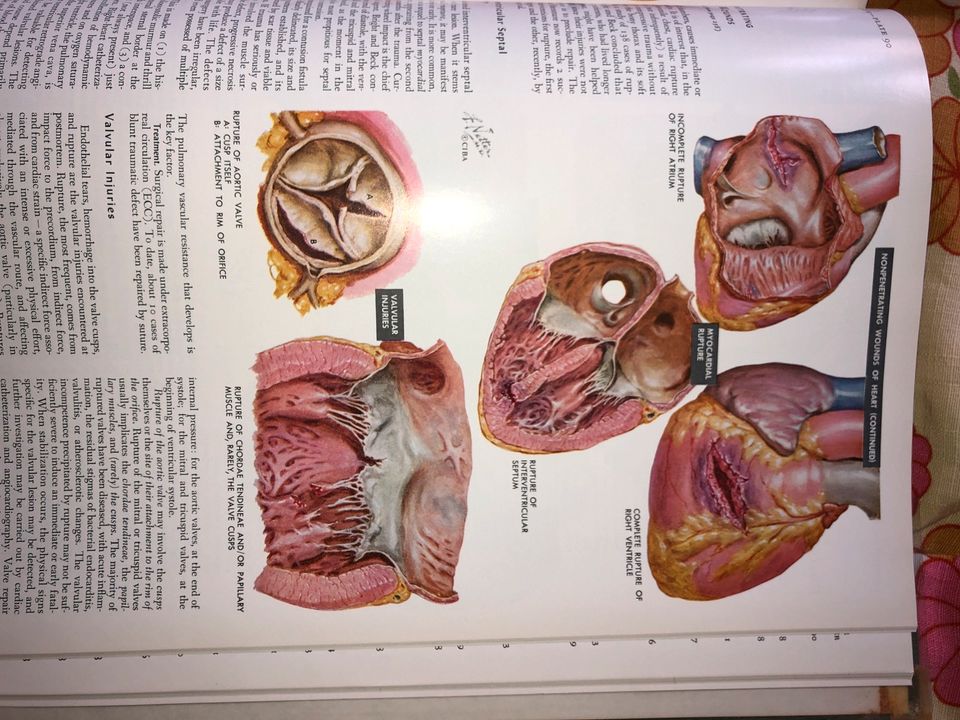 Medical Illustrations the Heart Frank Netter Buch in München