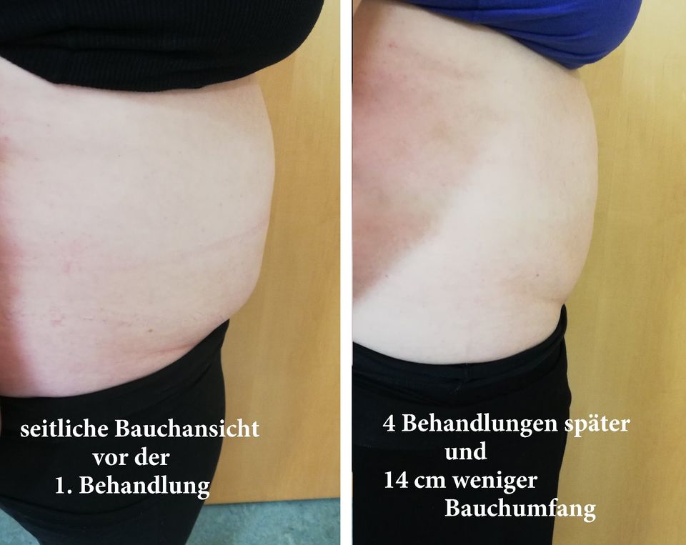 ABNEHMEN / GELD - ZURÜCK - GARANTIE BEI NICHTERFOLG in Paderborn