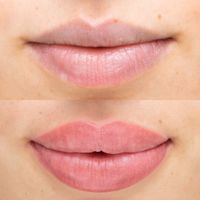 Modelle für Lippenpigmentierung PMU gesucht Köln - Köln Merheim Vorschau