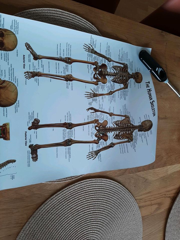 Toll beschriebenes Poster von menschlichen Skelett in Mannheim