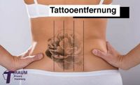 Tattooentfernung  Tattoolaser Lasertattoo Tattoo entferne Hamburg Hamburg-Mitte - Hamburg Altstadt Vorschau