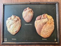 Schulkarte Wandkarte Anatomie Unterricht Antik Essen - Essen-Stadtwald Vorschau