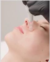 Medi-Health-Beauty Master Schulung -ohne NISV freie Geräten Hessen - Bad Vilbel Vorschau