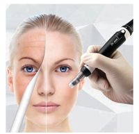 Microneedling Hessen - Ehringshausen Vorschau