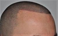 270 €-3 St. Scalp Pigmentierung Haar-Imitation Haarverdichtung Schleswig-Holstein - Bad Oldesloe Vorschau