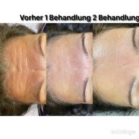 Aktion Gesichtsreinigung plus Seidenfaden Collagen Lifting Saarland - Marpingen Vorschau