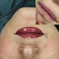 Permanent Make-Up Lippen Duisburg - Duisburg-Süd Vorschau