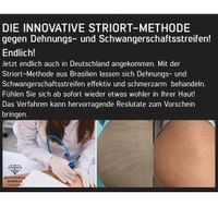 Dehnungs- und Schwangerschaftsstreifen! Behandlung    Neu Nordrhein-Westfalen - Ibbenbüren Vorschau