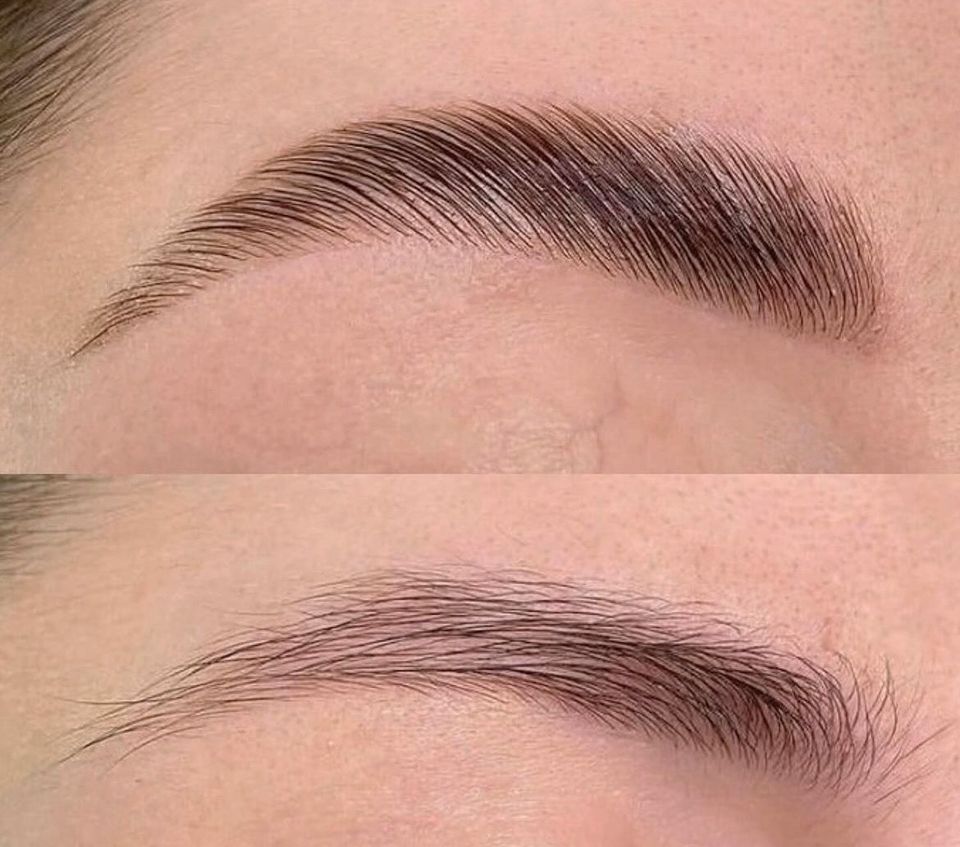 BROWLIFTING | WIMPERNLIFTING in Berlin