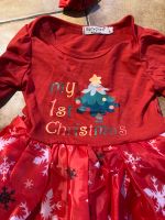 Neu & OVP Baby Body Kleid Weihnachten Bayern - Bad Tölz Vorschau