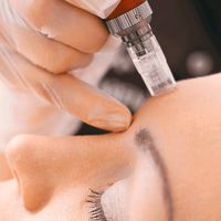 Micro Needling Nordrhein-Westfalen - Sankt Augustin Vorschau