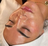 HYDRAFACIAL Tiefenreinigung, Strahlende Haut Pankow - Prenzlauer Berg Vorschau