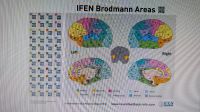 Neurologisches Poster Integrativ A 1 Nordrhein-Westfalen - Troisdorf Vorschau