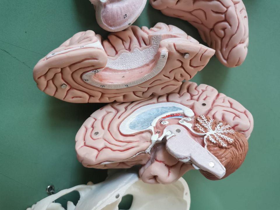 menschliches schädelmodell mit gehirn, 8 teilig, anatomie, modell in Fürth