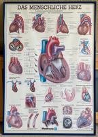 MEDTRONIC Das menschliche Herz Poster Kardiologie Kreis Pinneberg - Pinneberg Vorschau