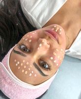 Hochwertiges BB-Glow SkinExpert Microneedling Eimsbüttel - Hamburg Eimsbüttel (Stadtteil) Vorschau