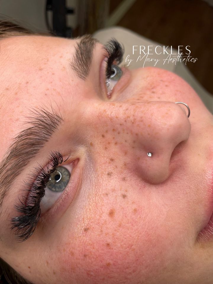 Fake Freckles Sommersprossen Pigmentierung Permanent Make up pmu in Herne