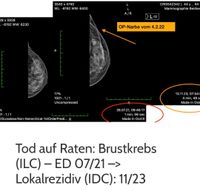 Onkologe im Ruhestand gesucht Niedersachsen - Rastede Vorschau