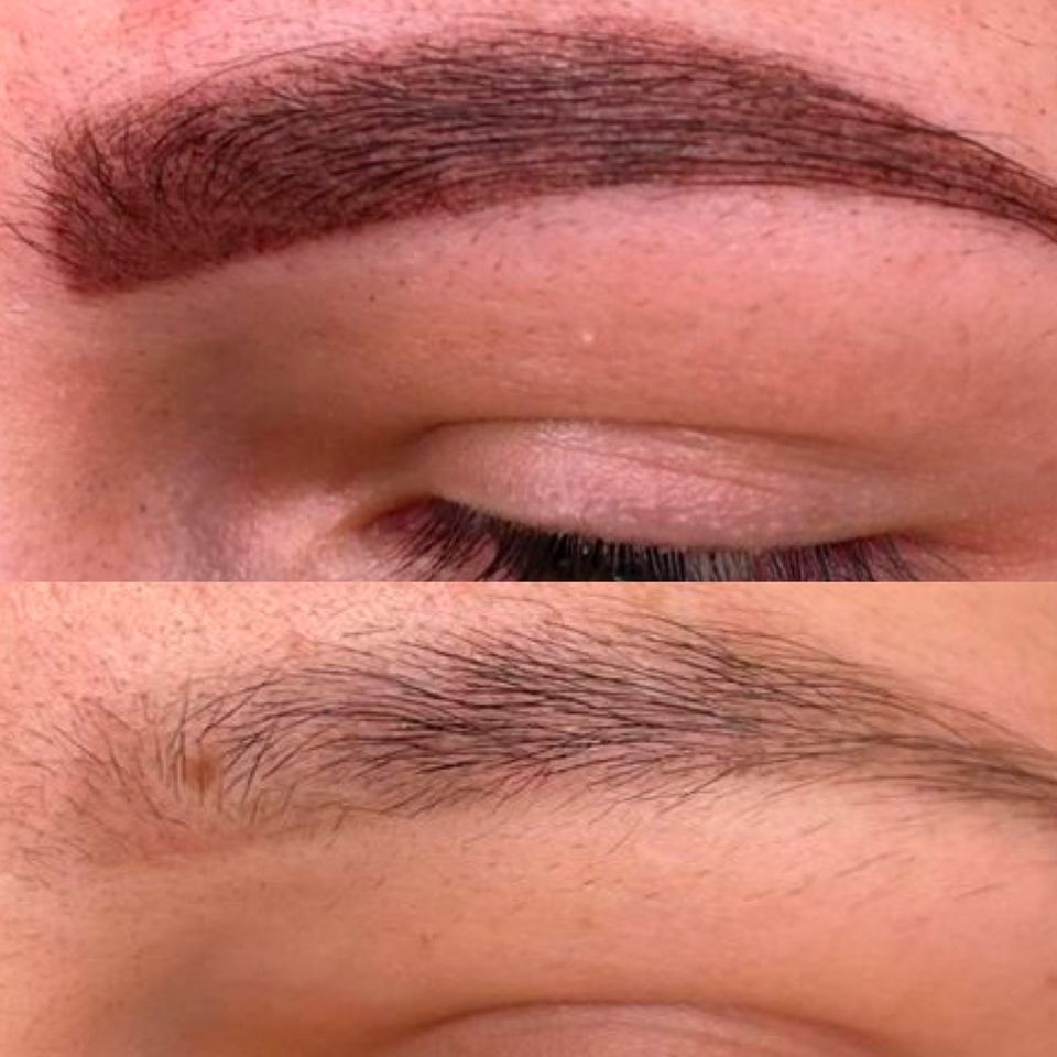 Entfernen von Microblading und PMU effektiv mit Remover in Köln