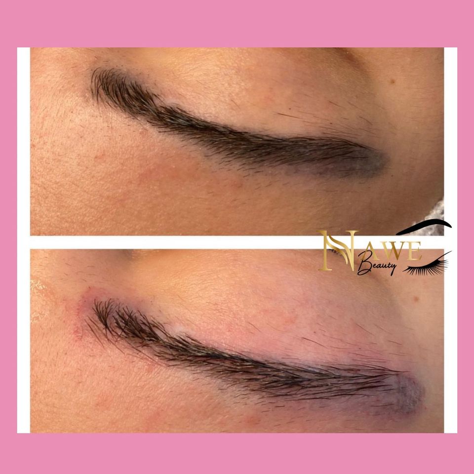 Entfernung Microblading Permanent Make up Aufhellung Remover in Gelsenkirchen