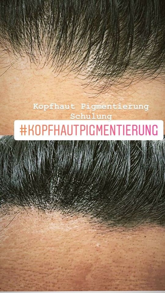 Kopfhautpigmentierung -Scalp -Haarneedling Schulung in Bad Vilbel