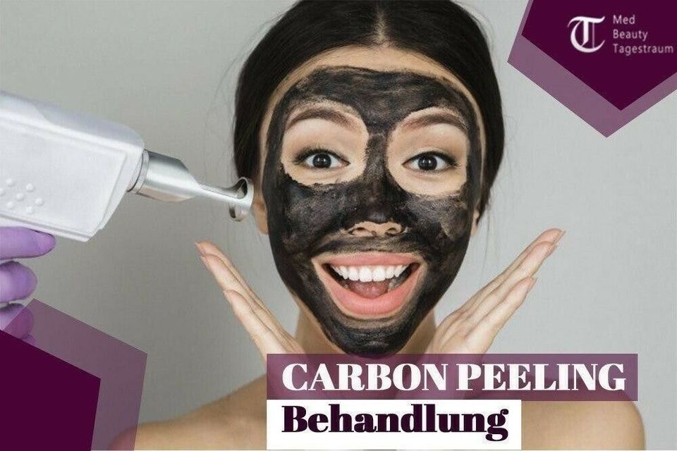 Laser-Peeling mit Carbon Peeling Hautverjüngerung Akne ANGEBOT Ha in Hamburg