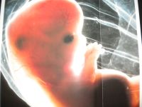 Embryonalentwicklung 1.Tag bis 9.Monat Baby Frankfurt am Main - Sachsenhausen Vorschau