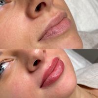 BB-Lips|Semi Permanent-Make up, auch mit Hyaluron Kombinierbar Nordrhein-Westfalen - Nettetal Vorschau