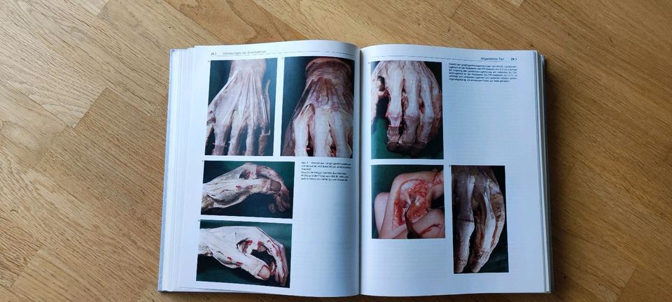 Handchirurgie in 2 Bänden, Nigst, Buck-Gramcko, Millesi in Bergisch Gladbach
