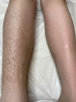 Waxing/Sugaring/ Haarentfernung Niedersachsen - Melle Vorschau