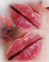 Russian Lippenunterspritzung -Russian Lips - Berlin - Charlottenburg Vorschau