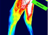 Pferdethermographie Sattel - Thermographie Stuttgart - Stuttgart-Süd Vorschau