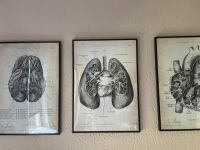 Anatomische Poster mit Rahmen von Animus Medicus Essen - Bergerhausen Vorschau