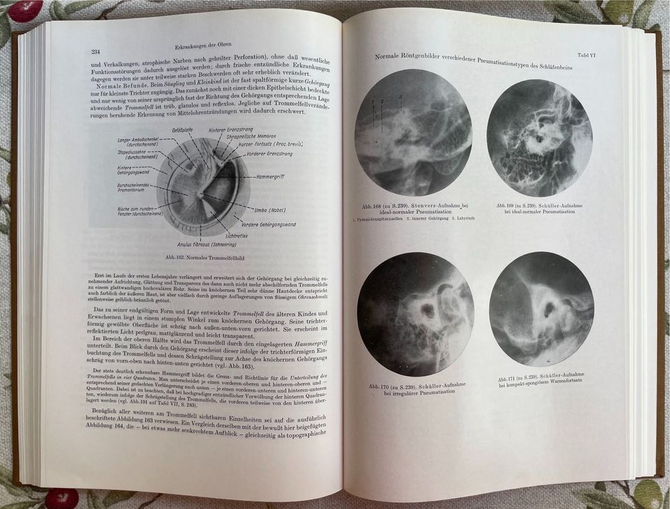 Lehrbuch der Hals-Nasen-Ohren-Heilkunde,HNO in Weimar