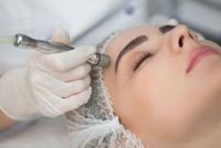 Mikrodermabrasion Gesichtsbehandlung/ Microdermabrasion Hessen - Kassel Vorschau