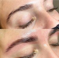 Brow Lifting Schleswig-Holstein - Elmshorn Vorschau