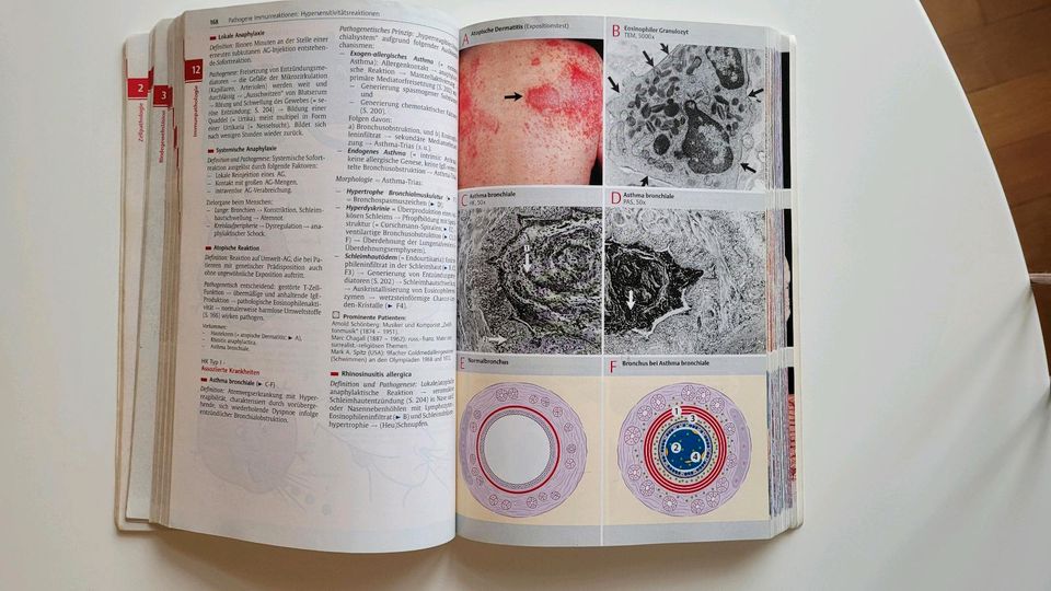 Taschenatlas der allgemeinen Pathologie Thieme in München