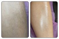 Waxing / Sugaring Nordrhein-Westfalen - Halle (Westfalen) Vorschau